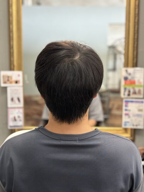 写真：Before