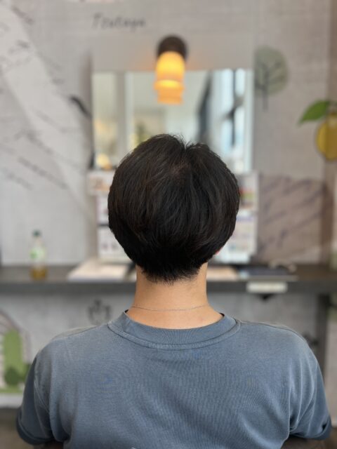 写真：Before