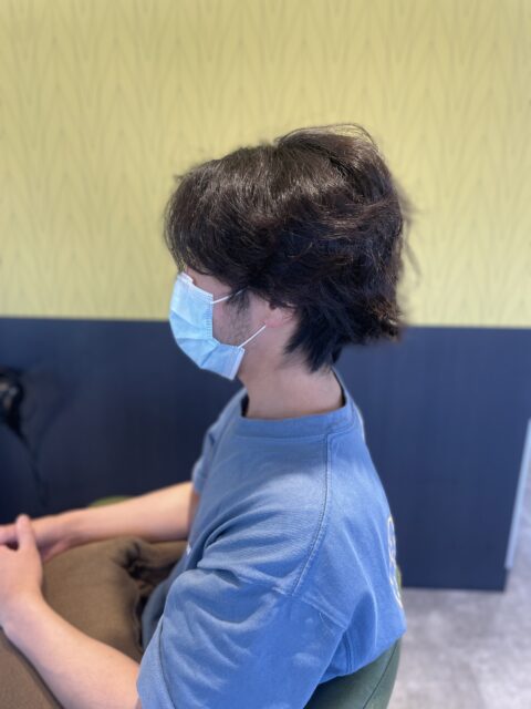 写真：Before